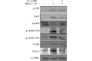 Effects of quercetin on the inflammatory response in H2O2-treated H9C2 cells.