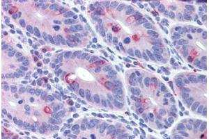Mouse small intestine: Formalin-Fixed, Paraffin-Embedded (FFPE) (IFIH1 anticorps  (C-Term))