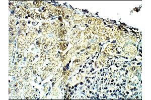 Detecting C4a in Baboon Liver using ABIN2749472