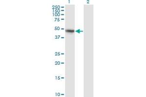 Western Blot analysis of CBLC expression in transfected 293T cell line by CBLC monoclonal antibody (M01), clone 3F10. (CBLC anticorps  (AA 1-474))