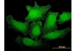 Immunofluorescence of monoclonal antibody to SMG1 on HeLa cell.