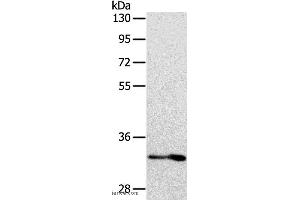 Western blot analysis of Human fetal intestine tissue, using IL1RL1 Polyclonal Antibody at dilution of 1:700 (IL1RL1 anticorps)