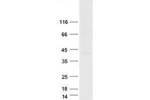 Validation with Western Blot