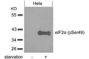 Image no. 3 for anti-Eukaryotic Translation Initiation Factor 2 Subunit 1 (EIF2S1) (pSer49) antibody (ABIN319276) (EIF2S1 anticorps  (pSer49))