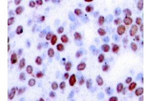 Image no. 1 for anti-Jun Proto-Oncogene (JUN) antibody (ABIN265353) (C-JUN anticorps)