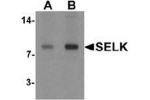 Western blot analysis of SELK in A20 cell lysate with SELK antibody at (A) 1 and (B) 2 μg/ml. (Selenoprotein K anticorps  (C-Term))