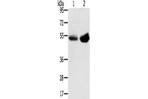 Western Blotting (WB) image for anti-Solute Carrier Family 13 Member 3 (SLC13A3) antibody (ABIN2427263) (SLC13A3 anticorps)