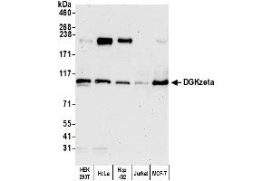 Western Blotting (WB) image for anti-Diacylglycerol Kinase, zeta (DGKZ) (AA 1067-1117) antibody (ABIN7454557)