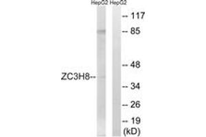 Western Blotting (WB) image for anti-Zinc Finger CCCH-Type Containing 8 (ZC3H8) (AA 81-130) antibody (ABIN2879217) (ZC3H8 anticorps  (AA 81-130))