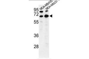 Western blot analysis of BEST2 Antibody (C-term) in MDA-MB435,MDA-MB231 cell line lysates (35µg/lane). (Bestrophin 2 anticorps  (C-Term))