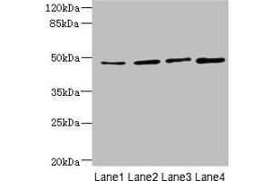 Western blot All lanes: TTC5 antibody at 6 μg/mL Lane 1: HepG2 whole cell lysate Lane 2: A549 whole cell lysate Lane 3: MCF-7 whole cell lysate Lane 4: Mouse kidney tissue Secondary Goat polyclonal to rabbit IgG at 1/10000 dilution Predicted band size: 49 kDa Observed band size: 49 kDa (TTC5 anticorps  (AA 201-440))