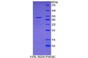 SDS-PAGE (SDS) image for Pyruvate Dehydrogenase Phosphatase (PDP) (AA 315-537) protein (His tag) (ABIN1879608) (PDP Protein (AA 315-537) (His tag))