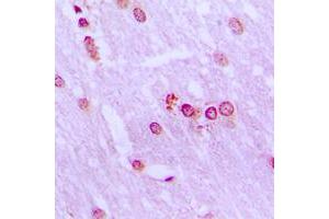 Immunohistochemical analysis of BRD3 staining in human brain formalin fixed paraffin embedded tissue section.