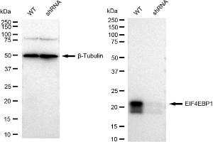 Western blotting analysis using EIF4EBP1 antibody (ABIN7798531).