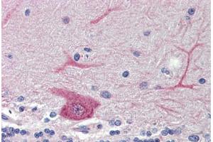 Brain, cerebellum, Human: Formalin-Fixed, Paraffin-Embedded (FFPE)