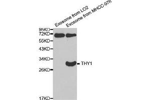 Western blot analysis of extracts of exosome from various cell lines, using THY1 antibody. (CD90 anticorps  (AA 20-130))