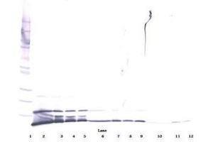 Image no. 2 for anti-Chemokine (C-X-C Motif) Ligand 1 (Melanoma Growth Stimulating Activity, Alpha) (CXCL1) antibody (ABIN464980) (CXCL1 anticorps)