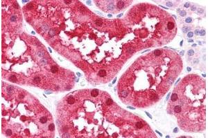 Human Kidney: Formalin-Fixed, Paraffin-Embedded (FFPE)