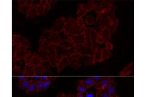 Immunofluorescence analysis of HeLa cells using KLRK1 Polyclonal Antibody at dilution of 1:100. (KLRK1 anticorps)