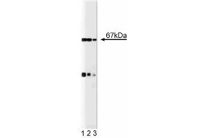 Western blot analysis of p67 [phox] on a EB-1 cell lysate (Human B lymphoblast, Burkitt's lymphoma, ATCC HTB-60).