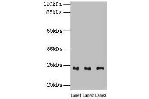 Western blot All lanes: RAB4B antibody at 4 μg/mL Lane 1: Mouse stomach tissue Lane 2: Mouse kidney tissue Lane 3: Mouse gonadal tissue Secondary Goat polyclonal to rabbit IgG at 1/10000 dilution Predicted band size: 24, 28 kDa Observed band size: 24 kDa (RAB4B anticorps  (AA 2-213))