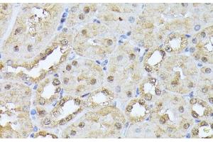 Immunohistochemistry of paraffin-embedded Mouse kidney using PSMB3 Polyclonal Antibody at dilution of 1:100 (40x lens). (PSMB3 anticorps)