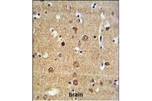 AD Antibody (Center) (ABIN653772 and ABIN2843064) IHC analysis in formalin fixed and paraffin embedded brain tissue followed by peroxidase conjugation of the secondary antibody and DAB staining. (ADAM19 anticorps  (AA 207-236))