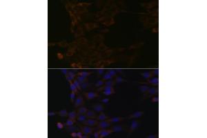 Immunofluorescence analysis of NIH-3T3 cells using HSP Rabbit mAb (ABIN1679173, ABIN3015940, ABIN3015941 and ABIN7101465) at dilution of 1:100 (40x lens).