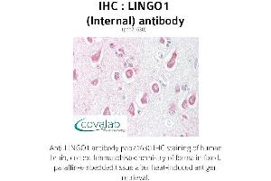 Image no. 1 for anti-Leucine Rich Repeat and Ig Domain Containing 1 (LINGO1) (Internal Region) antibody (ABIN1736453)
