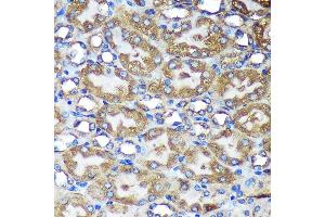 Immunohistochemistry of paraffin-embedded Mouse kidney using B Rabbit pAb (ABIN7265675) at dilution of 1:100 (40x lens).