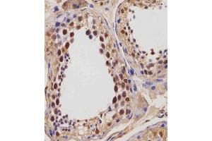 (ABIN654423 and ABIN2844158) staining IGF2BP1 in human testis tissue sections by Immunohistochemistry (IHC-P - paraformaldehyde-fixed, paraffin-embedded sections). (IGF2BP1 anticorps  (C-Term))