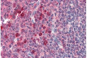 Human Tonsil (formalin-fixed, paraffin-embedded) stained with EXOC3 antibody ABIN364382 at 10 ug/ml followed by biotinylated anti-mouse IgG secondary antibody ABIN481714, alkaline phosphatase-streptavidin and chromogen.