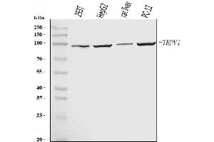 Western blot analysis of TRPV1 using anti-TRPV1 antibody (ABIN7599677).