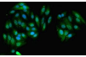 Immunofluorescent analysis of HepG2 cells using ABIN7154182 at dilution of 1:100 and Alexa Fluor 488-congugated AffiniPure Goat Anti-Rabbit IgG(H+L)