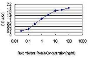 Detection limit for recombinant GST tagged IRX5 is approximately 0. (IRX5 anticorps  (AA 204-264))