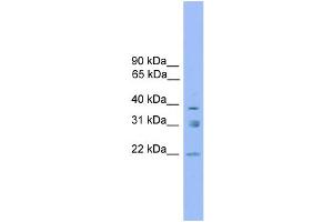 WB Suggested Anti-RNF167 Antibody Titration: 0. (RNF167 anticorps  (Middle Region))