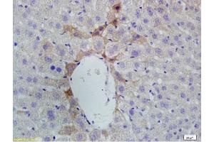 Formalin-fixed and paraffin embedded rat liver labeled with Anti-Vitamin D Receptor/VDR Polyclonal Antibody, Unconjugated (ABIN682513) at 1:200 followed by conjugation to the secondary antibody and DAB staining. (Vitamin D Receptor anticorps  (AA 65-180))