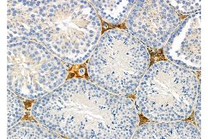 ABIN6260420 and ABIN6279238 at 1/100 staining Mouse testis tissue by IHC-P.