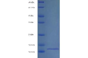 SDS-PAGE (SDS) image for Solute Carrier Family 34 (Sodium Phosphate), Member 2 (SLC34A2) (AA 574-689) protein (His tag) (ABIN5713842)