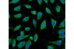 Immunofluorescence analysis of Hela tissue using HSP70 Monoclonal Antibody at dilution of 1:100.