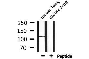 Western blot analysis of extracts from mouse lung, using CEP110 Antibody.