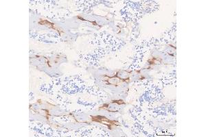 IHC analysis of COMP using anti-COMP antibody (ABIN6719297).