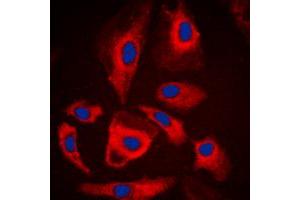 Immunofluorescent analysis of MARK staining in A549 cells. (MARK1 anticorps  (Center))