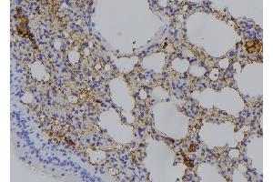ABIN6276570 at 1/100 staining Mouse lung tissue by IHC-P. (RAB11A anticorps  (C-Term))