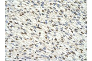 Rabbit Anti-DAZAP1 antibody         Paraffin Embedded Tissue:  Human Heart    cell Cellular Data:  cardiac cell    Antibody Concentration:  4.