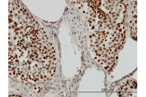 Image no. 1 for anti-PC4 and SFRS1 Interacting Protein 1 (PSIP1) (AA 1-51) antibody (ABIN599171) (PSIP1 anticorps  (AA 1-51))