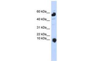 Image no. 1 for anti-Chromosome 1 Open Reading Frame 151 (C1orf151) (C-Term) antibody (ABIN6740907) (C1orf151 anticorps  (C-Term))