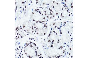 Immunohistochemistry of paraffin-embedded human stomach using Symmetric DiMethyl-Histone H3-R2 antibody (ABIN3016053, ABIN3016054, ABIN3016055, ABIN1680220 and ABIN6219534) at dilution of 1:100 (40x lens).