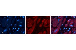 Rabbit Anti-UPF1 Antibody   Formalin Fixed Paraffin Embedded Tissue: Human heart Tissue Observed Staining: Cytoplasmic, nucleus Primary Antibody Concentration: 1:100 Other Working Concentrations: N/A Secondary Antibody: Donkey anti-Rabbit-Cy3 Secondary Antibody Concentration: 1:200 Magnification: 20X Exposure Time: 0. (RENT1/UPF1 anticorps  (Middle Region))