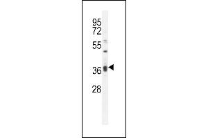 KLHL35 Antibody (C-term) (ABIN656072 and ABIN2845420) western blot analysis in MDA-M cell line lysates (35 μg/lane). (KLHL35 anticorps  (C-Term))